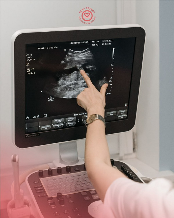 Ultrasound examination during a surrogacy program in Ukraine